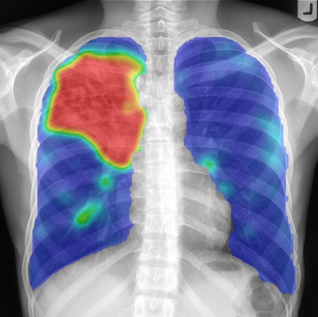 „In 10 Jahren arbeiten Pathologieabteilungen digital“