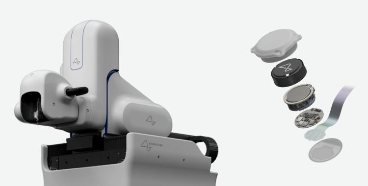 Neuralink: Freigabe für Versuche mit Hirn-Chip am Menschen erteilt