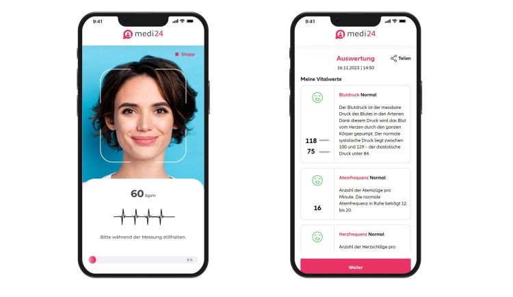 Health-Scanner von KPT: So werden die Daten verarbeitet