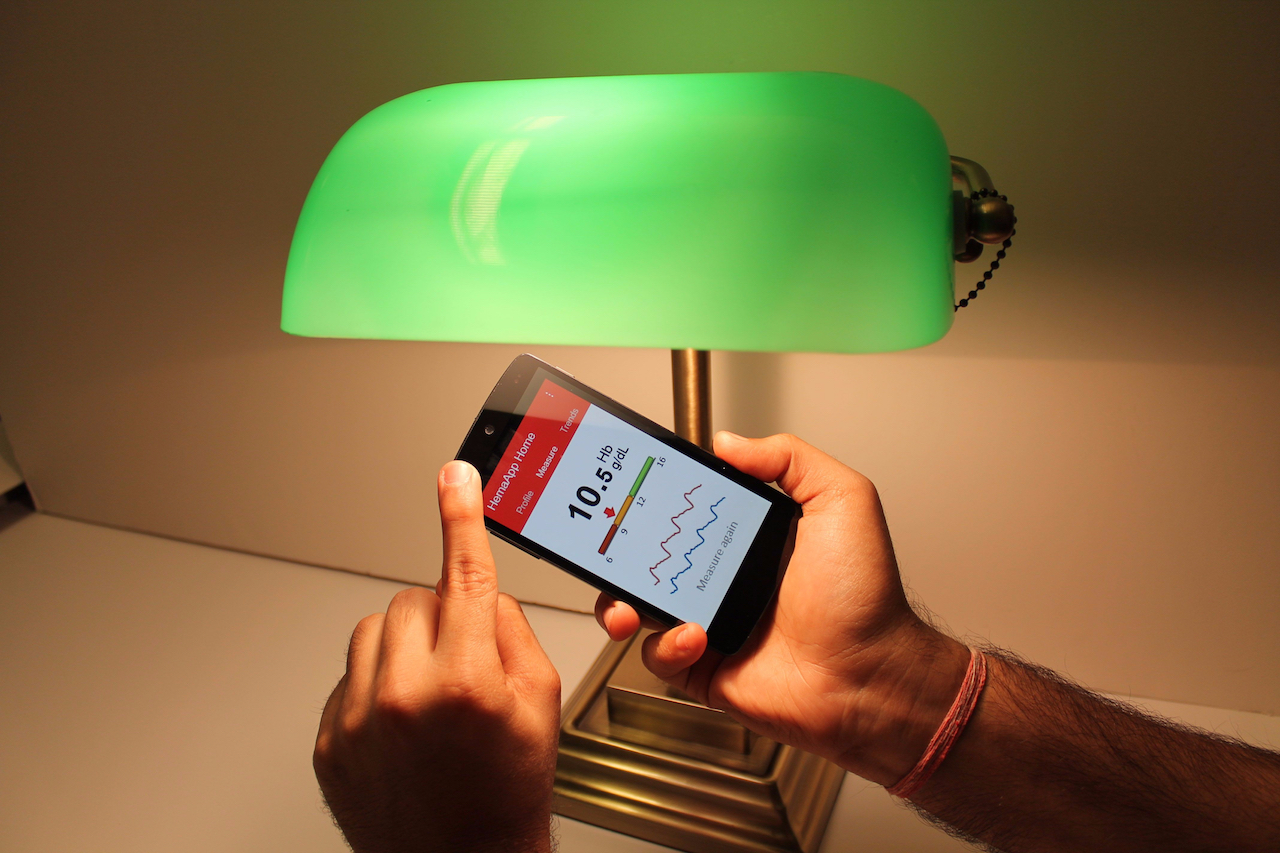 Google kauft Health-Monitoring-Start-up